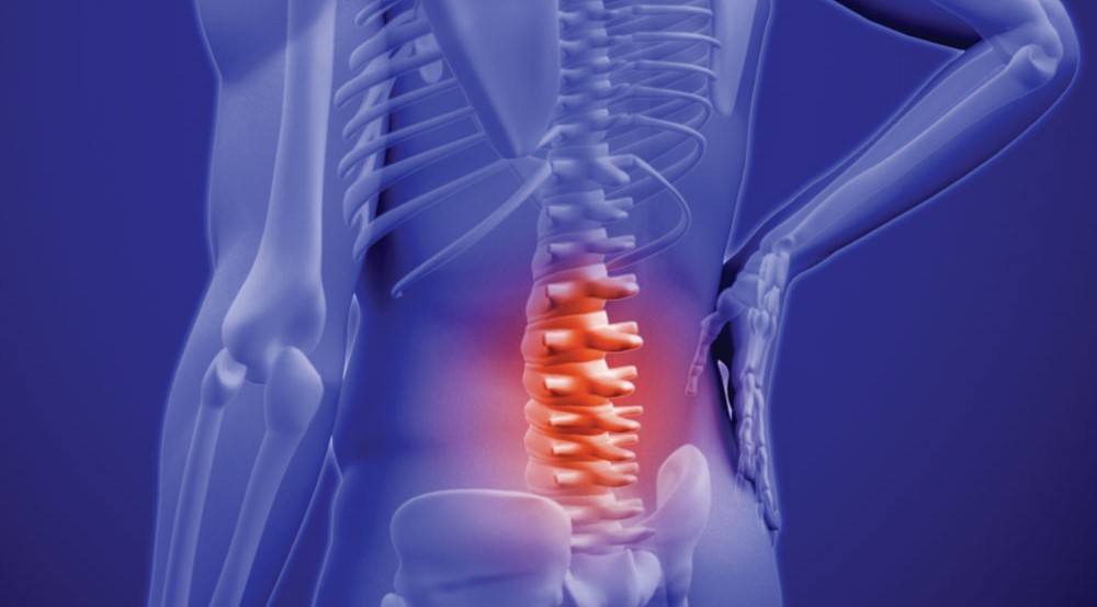 Lombalgia - Dr. Pedro Di Giovanni